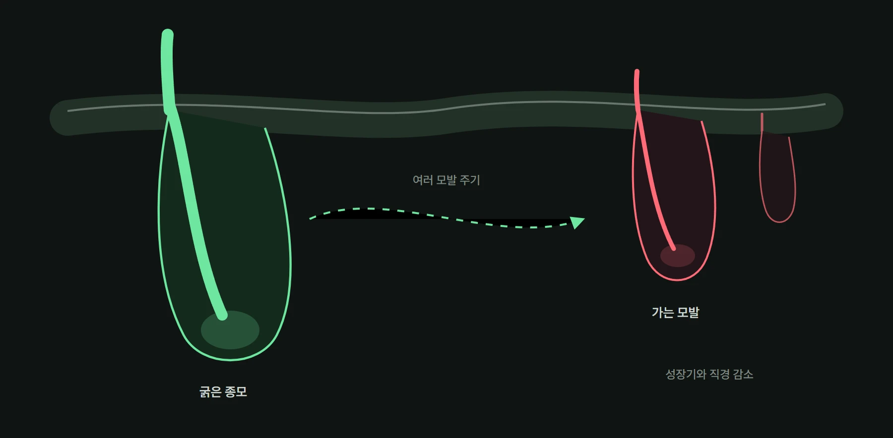 DHT는 어떻게 모낭을 줄이는가: 합성·수용체·탈모약의 과학 대표 이미지