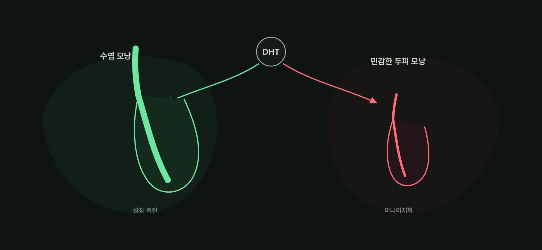 동일한 DHT 신호가 수염 모낭의 성장은 촉진하고 민감한 두피 모낭은 줄이는 대비