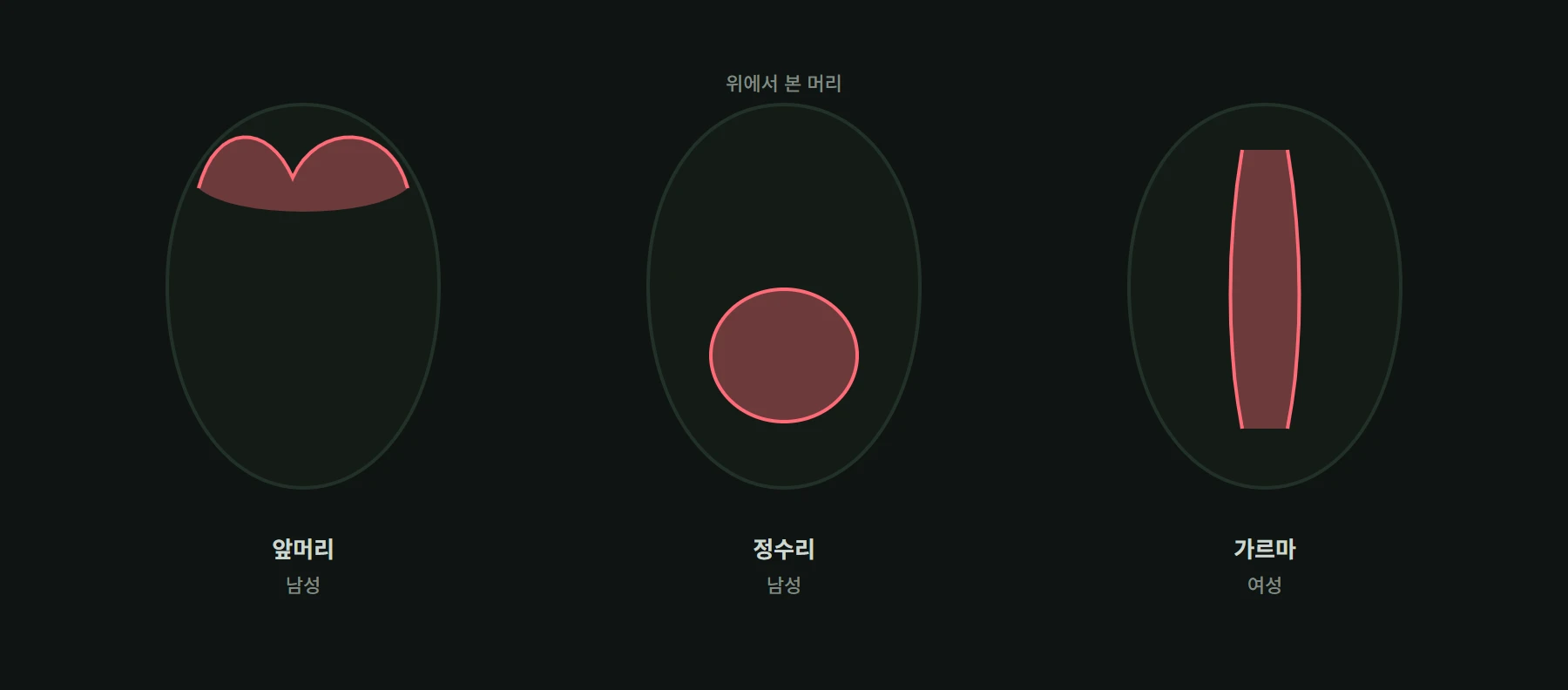 남성의 이마선 후퇴와 정수리 감소, 여성의 가르마 확장 형태 비교
